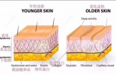 越化妆，痘痘越严重，我们到底该怎么办？